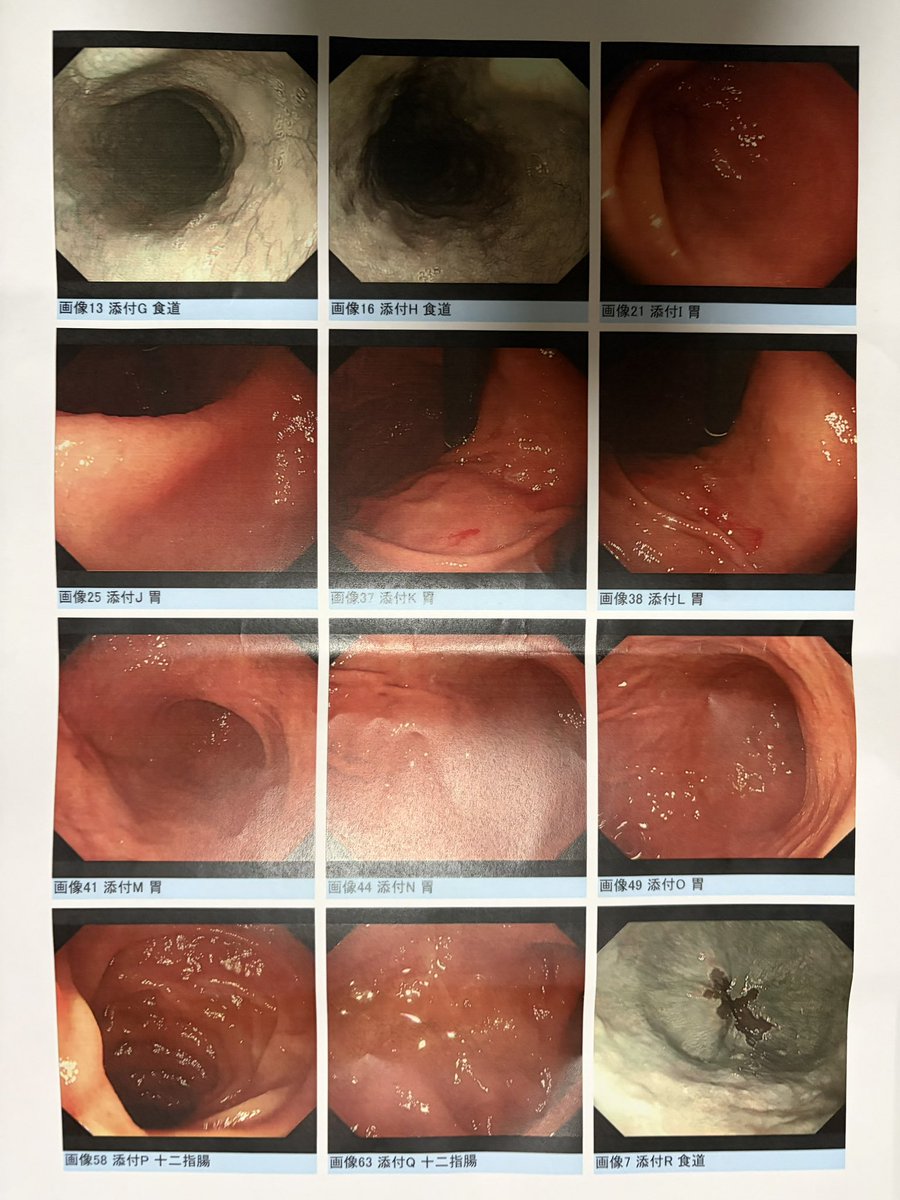 どんぐり2号 tweet media