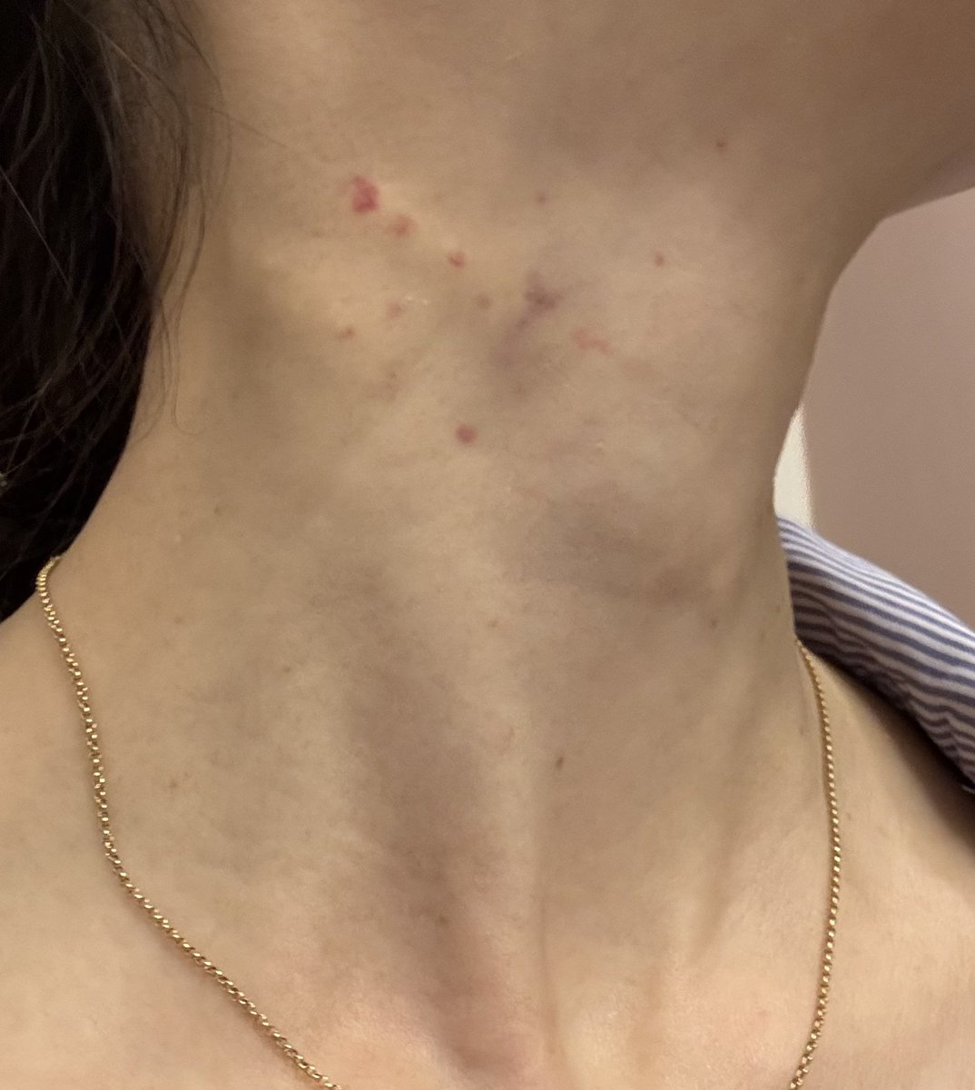 アラフォー韓国美容🇰🇷 tweet media