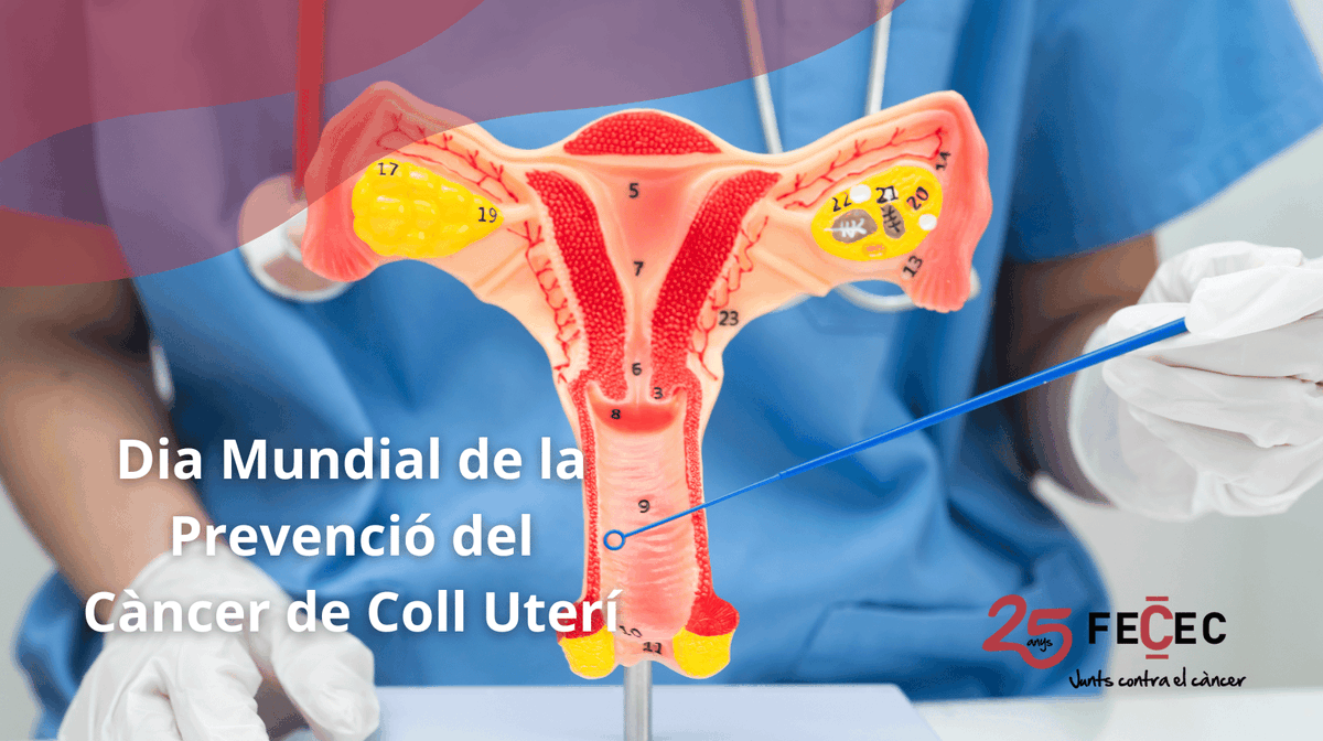 FececFederacio's tweet photo. El 26 de març 📅 es commemora el Dia Mundial de la Prevenció del #Càncer de Coll Uterí o de Cèrvix 🎗️.

📊 354 dones 👩 van ser diagnosticades l'any 2025 al nostre país d'aquest tipus de tumor, malaltia provocada principalment pel VPH🦠.

🔗 https://t.co/1tcJIuzfBr https://t.co/qQeNzwFEKc