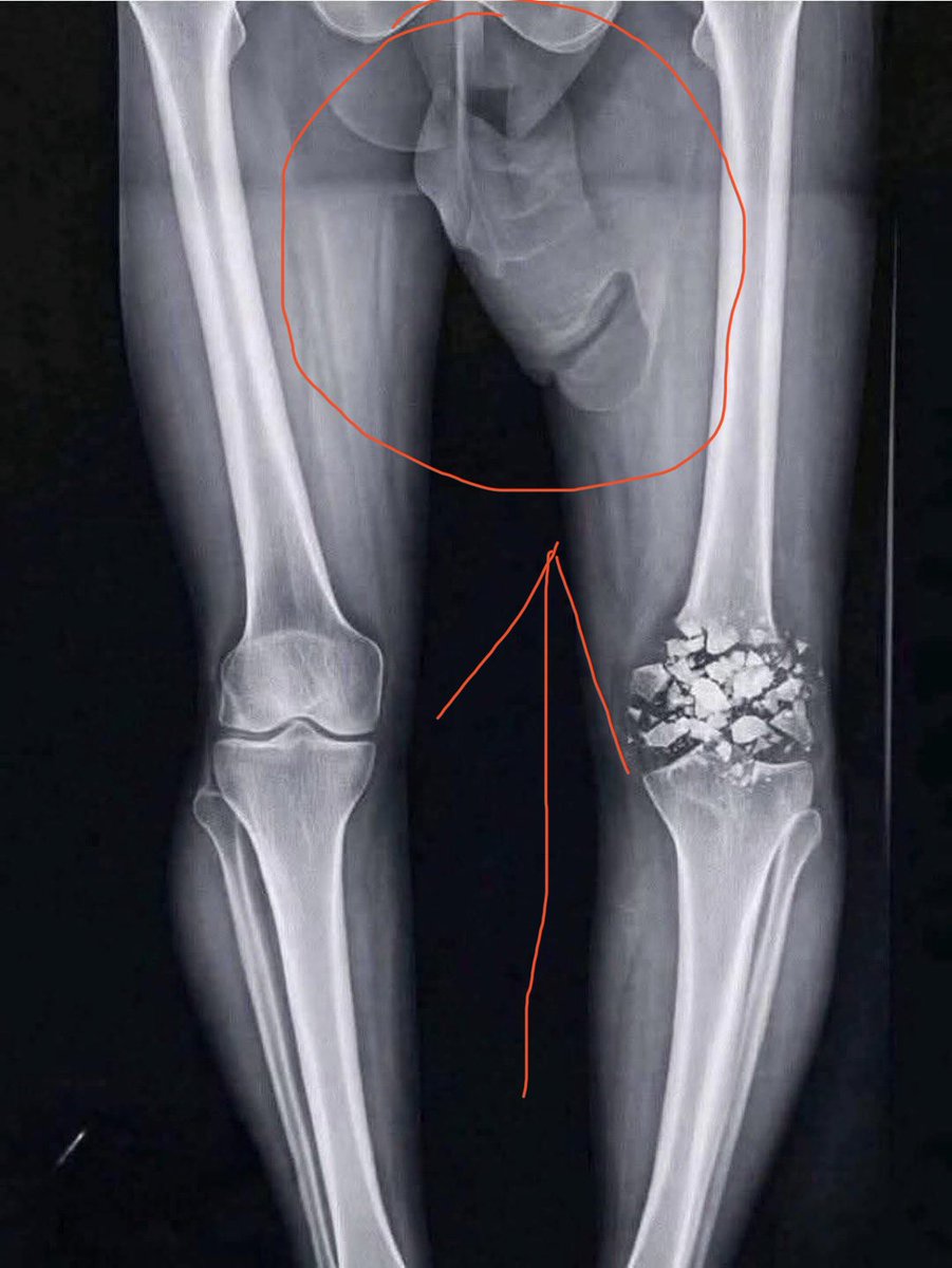 Black Rooster🏴 tweet media