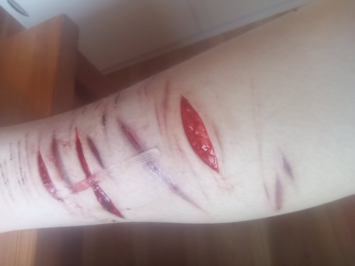 chocolatehurtstopurge tweet media