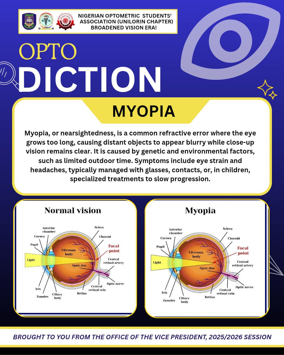NOSA_UNILORIN's tweet photo. It's another edition of OPTO DICTION! 👁️✨ 
Today, we are breaking down MYOPIA (Nearsightedness).
​From the anatomy of a myopic eye to management options like glasses and contacts, check out the graphic to learn more.
#EyeCare #NOSA #UNILORIN #MyopiaAwareness #OptometryStudents https://t.co/TInNFhLqfi