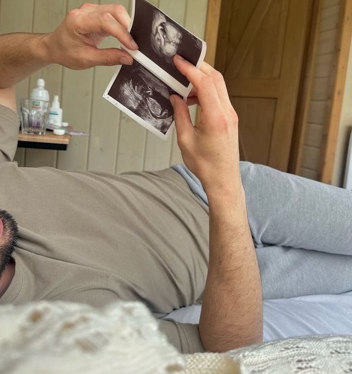 ... This man is trying to understand the ultrasound photo to see the gender.

Janna help me.