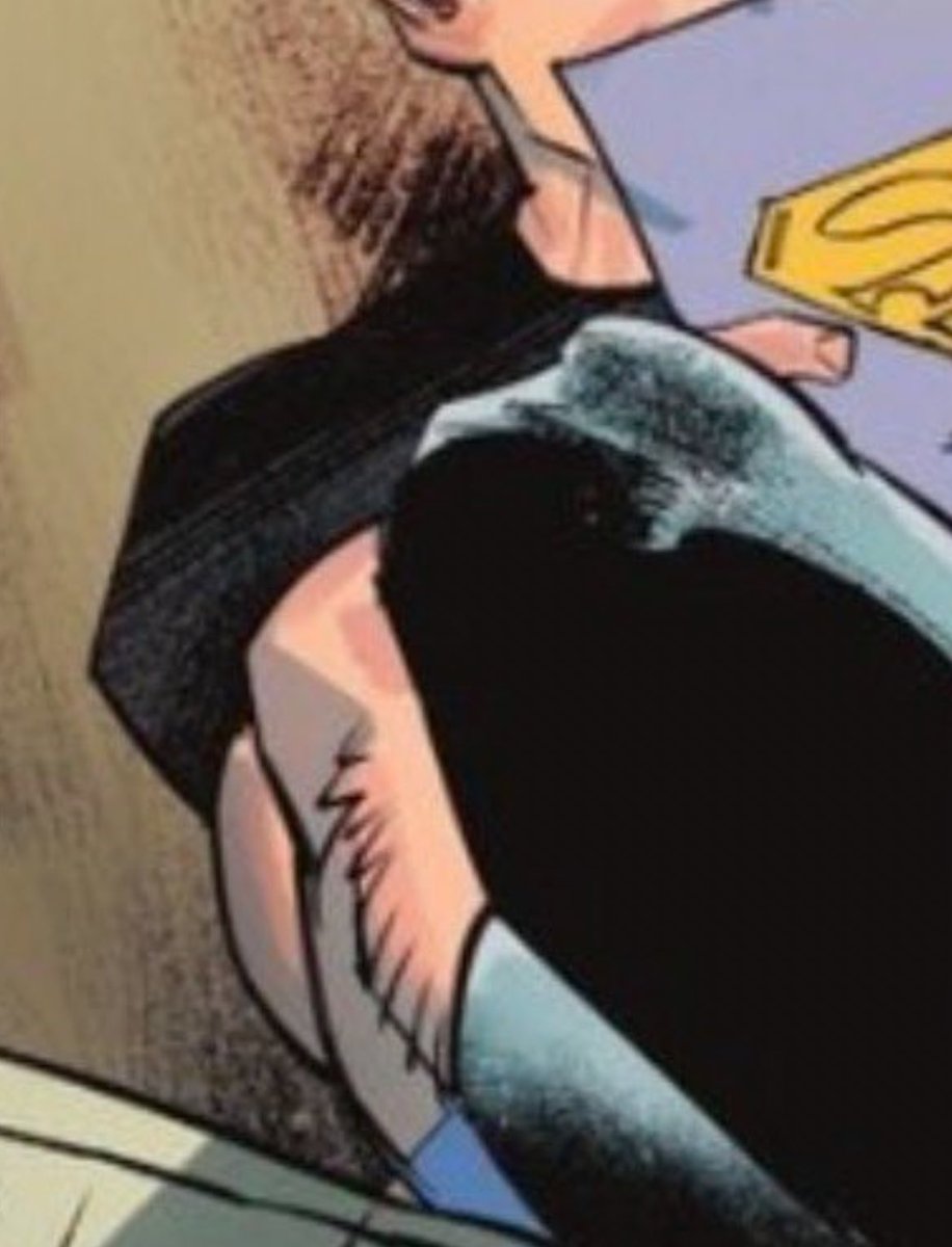 the_spy_wonder's tweet photo. notice the slight leg hair but no chest hair https://t.co/x2z6QeLEpb