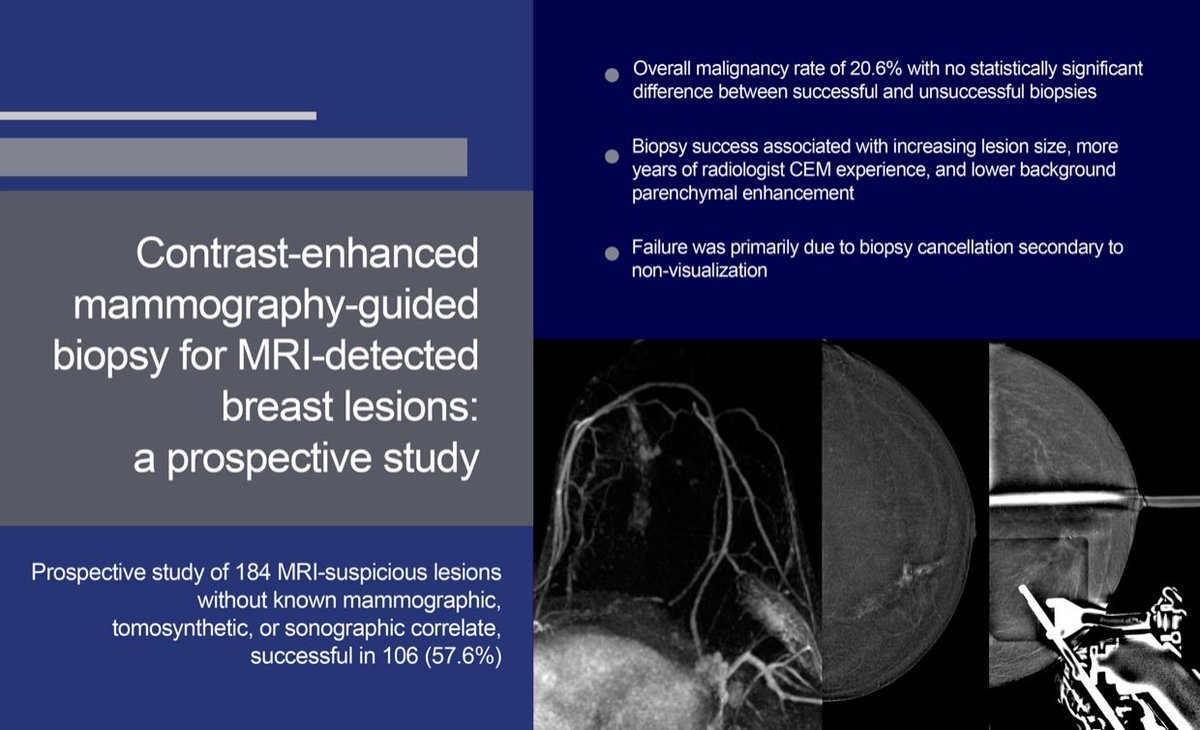 JBI_SBI's tweet photo. 📣 NEW ORIGINAL @BreastImaging RESEARCH 📣

- CEM-Bx successful: 57.6% lesns with 22.6% malign
- ⬆️ lesion size, ⬆️ years of rad CEM experience &amp; ⬇️ BPE assoctd with success
- CEM bx can be a successful alternative to MRI bx. Do MR bx if CEM-Bx fails.

📩 https://t.co/UGSbgZ9IhV https://t.co/TKbHyYILUY