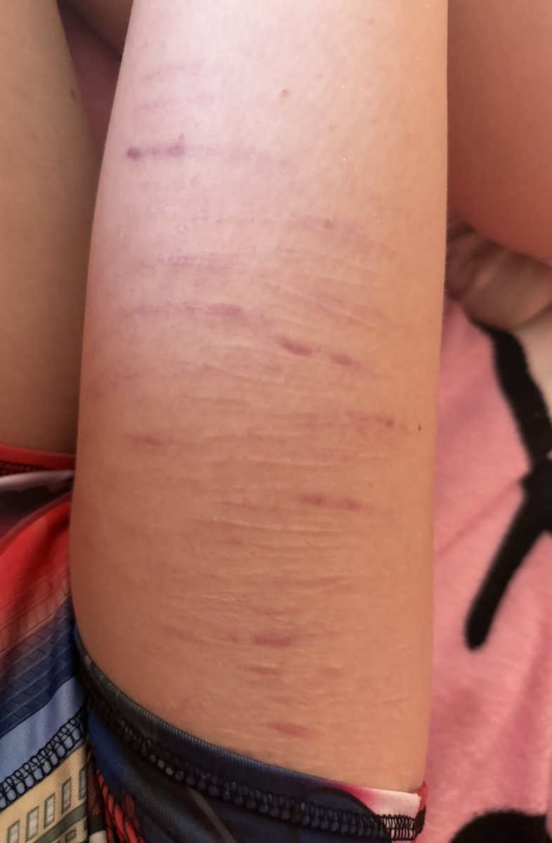 laura palmer of edtwt tweet media