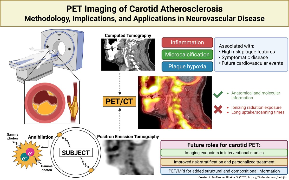 Stroke AHA/ASA tweet media