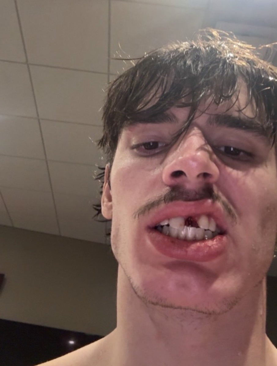 elle ⚡︎ tweet media