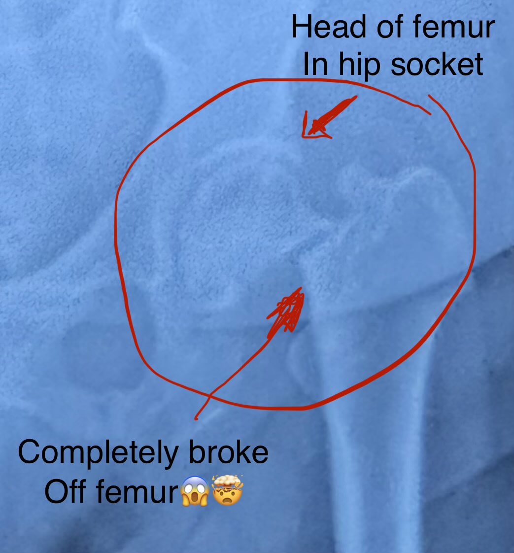 JeNiSe (ジェニス) ن 🍥 tweet media