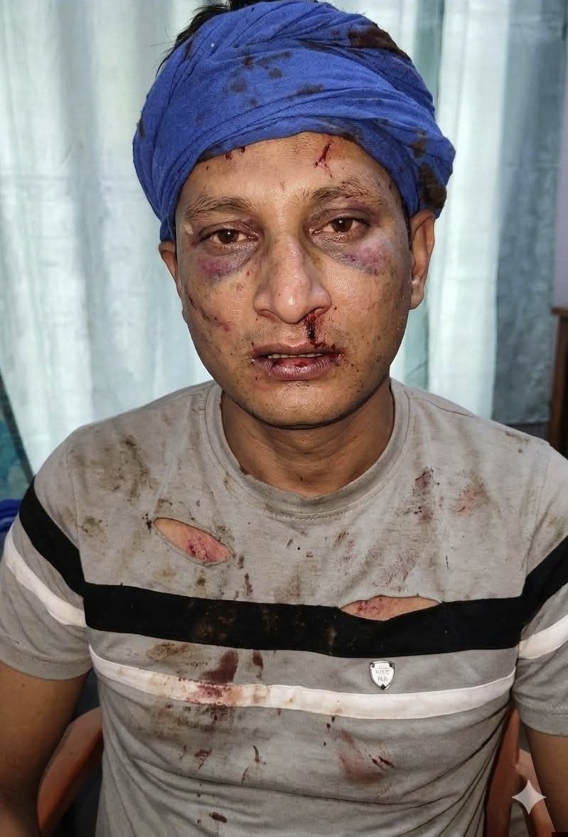 I.Mishra tweet media