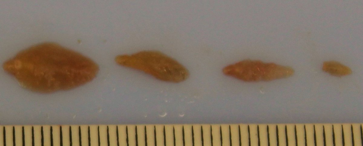COWSworms's tweet photo. It is vital to keep testing for liver fluke until the risk period is over. A negative test does not mean farmers can sit back and relax. It may be that fluke are not mature enough to lay eggs. Test again in 4 to 8 weeks time Photo: Wales Veterinary Science Centre https://t.co/k6J9Q1j74D