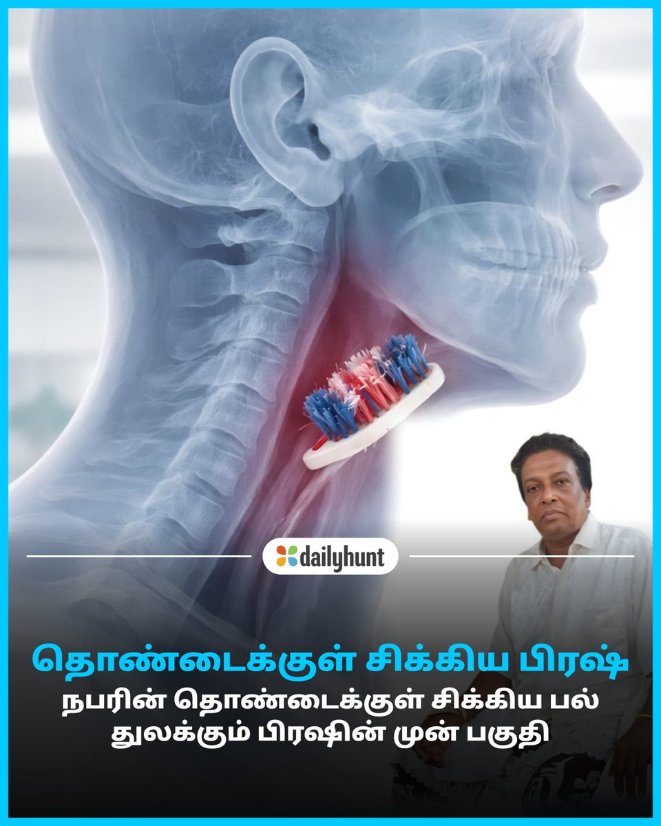 DH_Tamil's tweet image. ஷாக்.! குளியலறையில் வழுக்கி விழுந்த நபரின் தொண்டைக்குள் சிக்கிய பல் துலக்கும் பிரஷ்.
📸 Credit: AI

BBC Tamil மற்றும் பிற முன்னணி மூலங்களின் செய்திகளை இங்கே வாசிக்கவும். w.dhunt.in/13lwd2?partner…

#Toothbrush #DangerAlert #SurgerySuccess #BraveDoctors #Offbeat