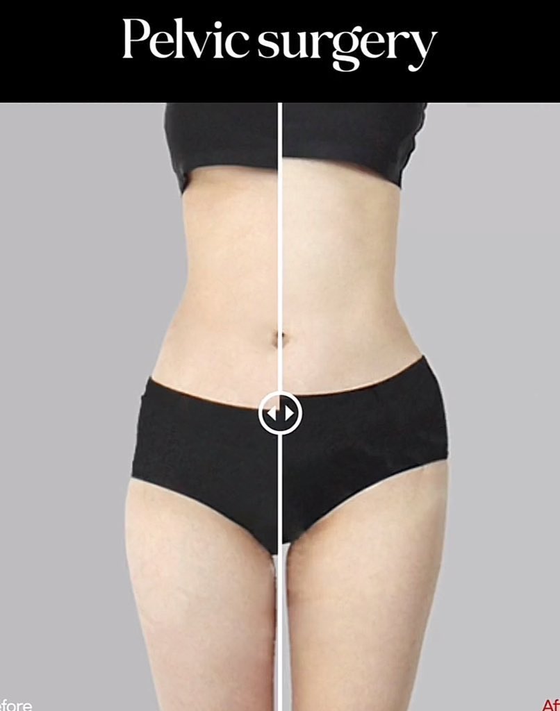 li0000ght tweet media