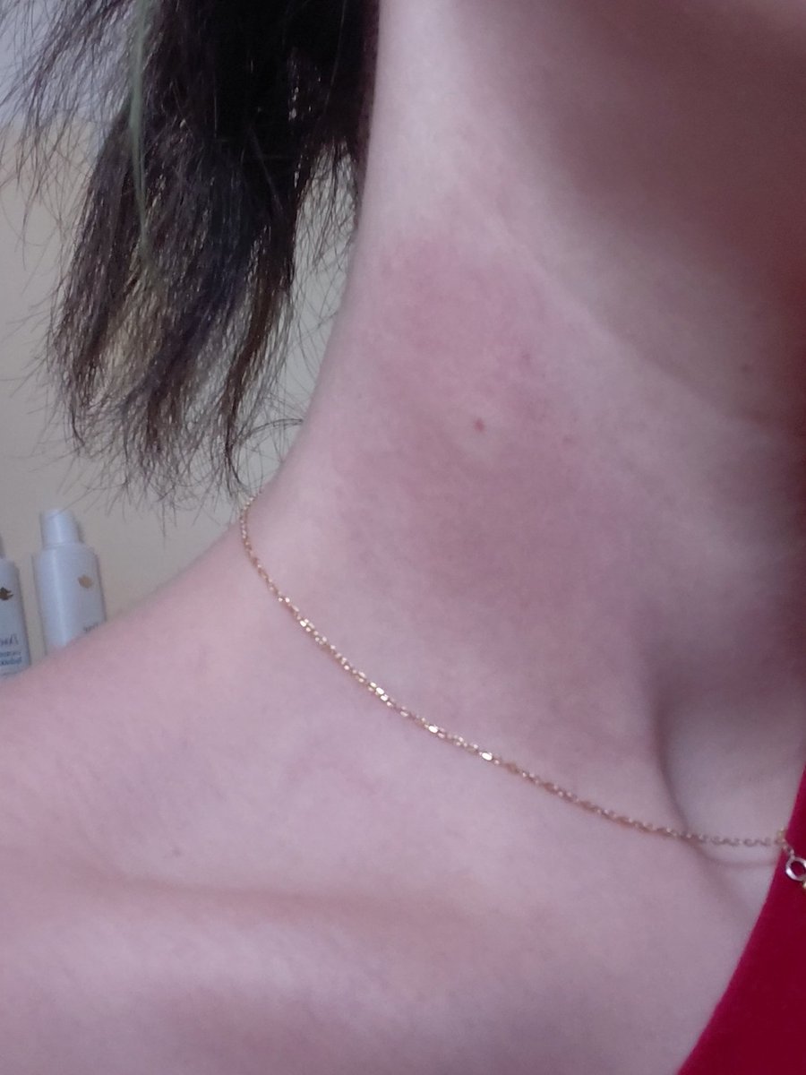 I got stung on the neck by a gosh darn warsp last night 🤬