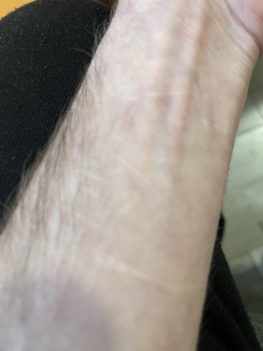 Baronn Hyu tweet media