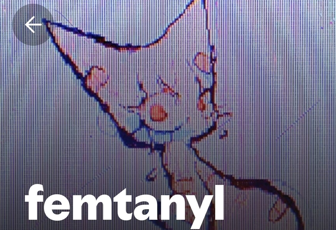 Ignite 凹ဗ tweet media