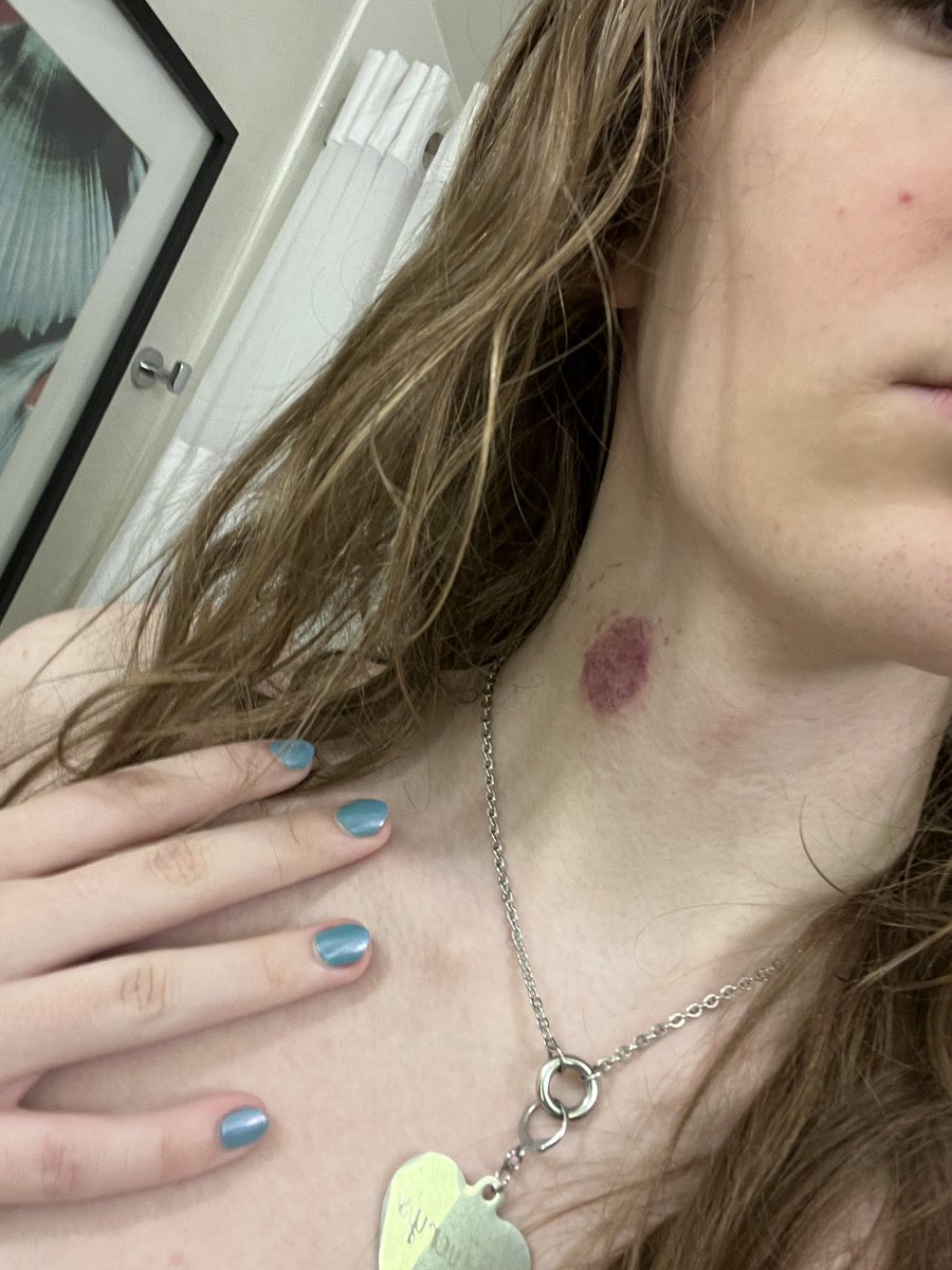 alice 🎧🌧️💤 tweet media