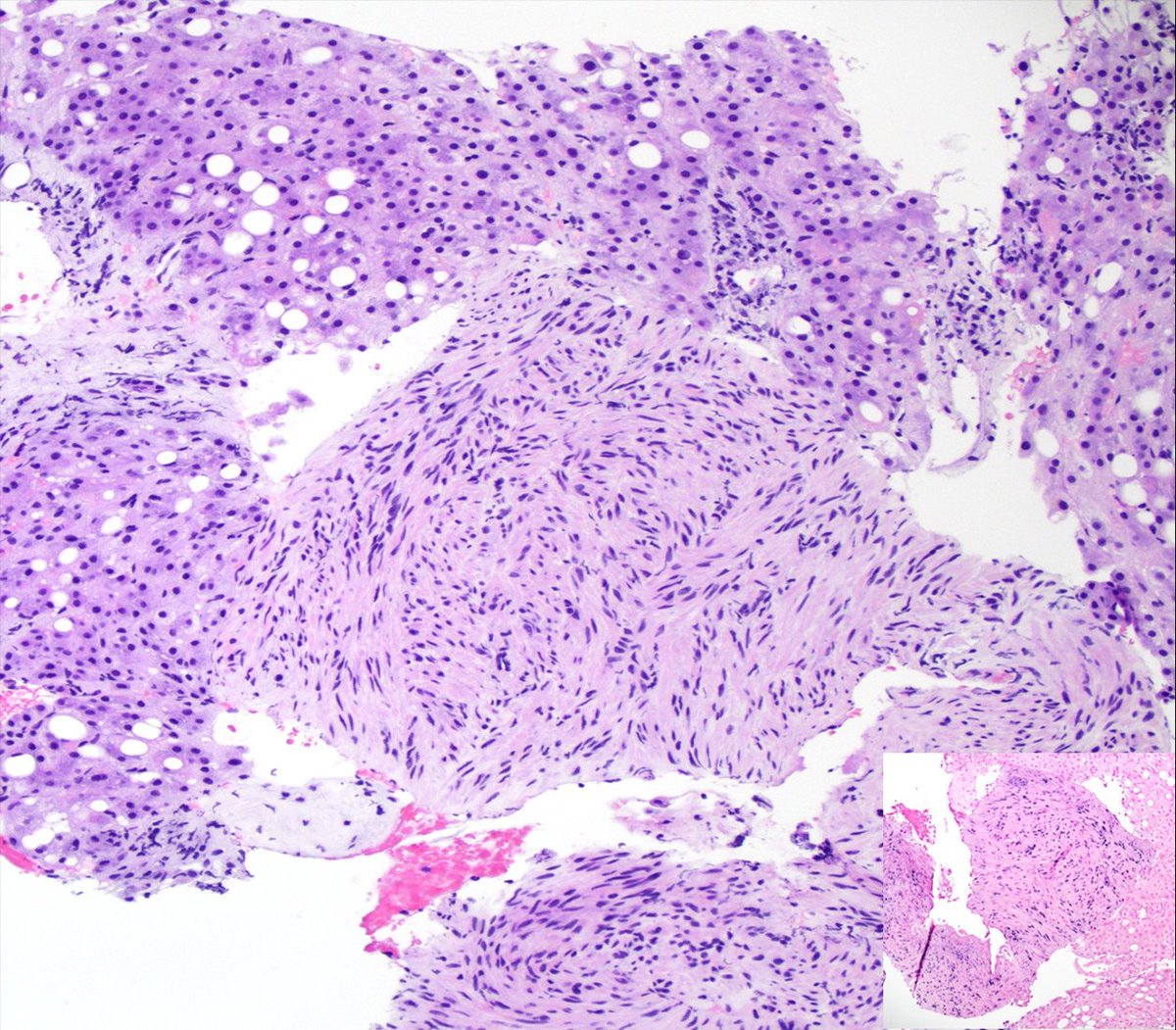 UTSW GI Pathology tweet media