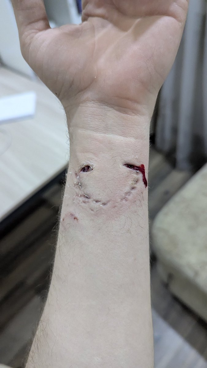 Мак-Столбняк tweet media