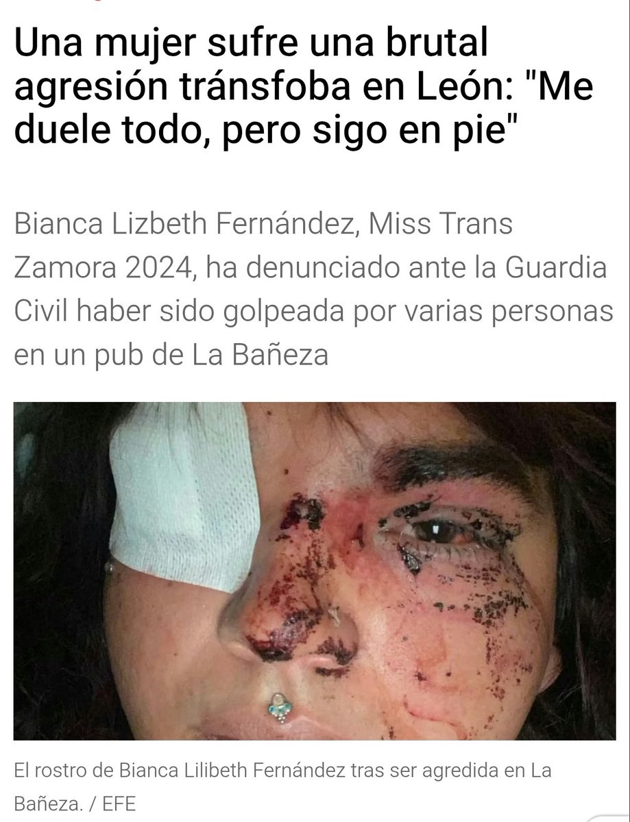 ¿Entonces, <a href="/SSantiagosegura/">Santiago Segura</a> , la ley trans es agresiva? 

¿La ley Trans te hace algo? ¿Te muerde, te pega, te araña? ¿Te salta y te coge de los "guebecillos"?

Los violentos que se envalentonan con comentarios como el tuyo si que son agresivos.
