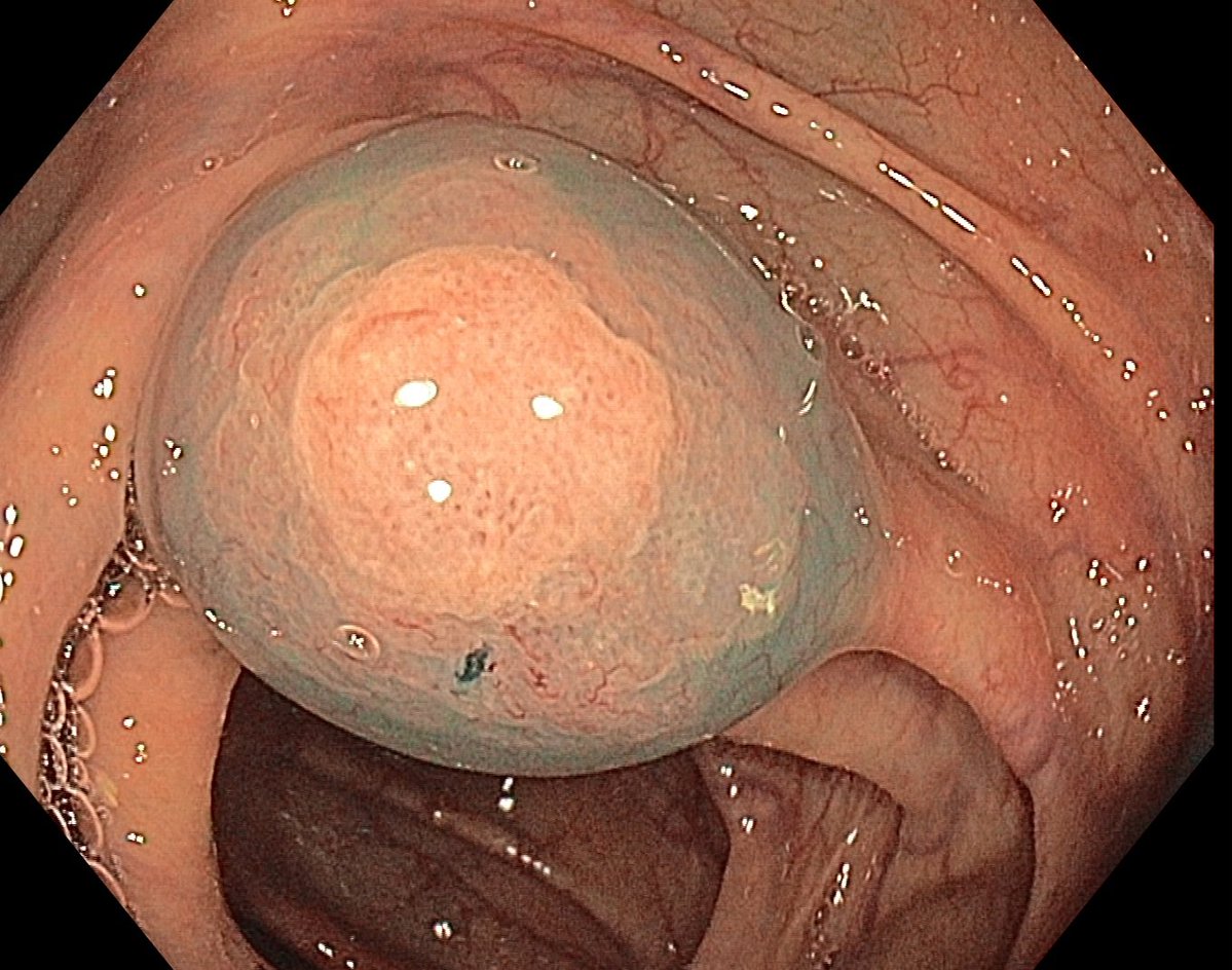 Aleksandar Gavric tweet media