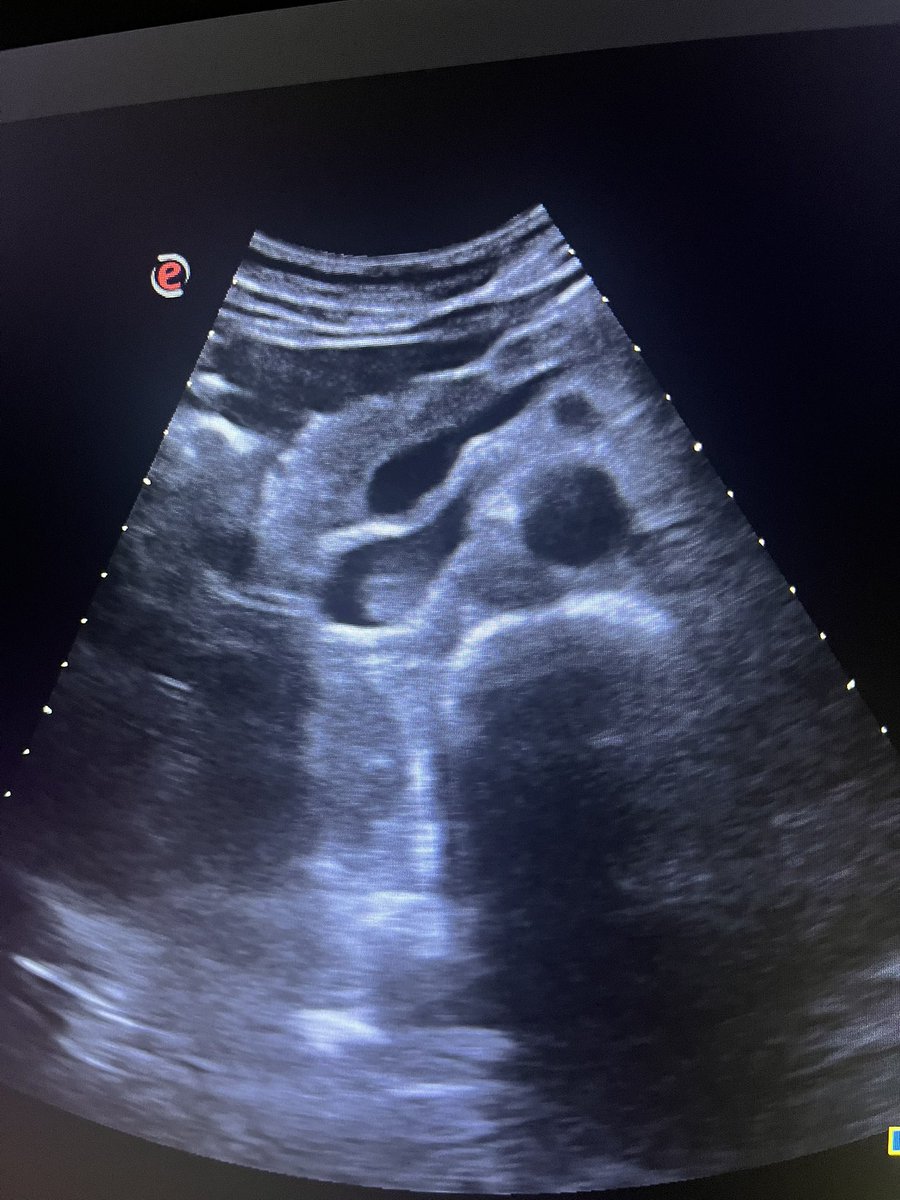 EcofrikisHCUV tweet media