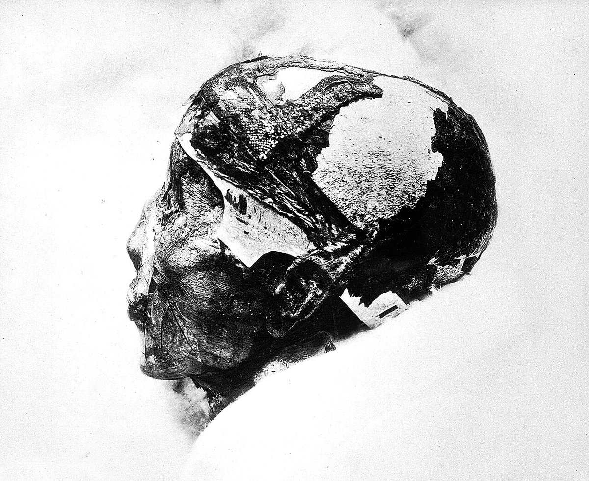 The head of #Tutankhamun, still bearing his fragile linen skull-cap (cap crown), preserved here in a fleeting moment before it disintegrated not long after this photograph was taken by Harry Burton, 1925.