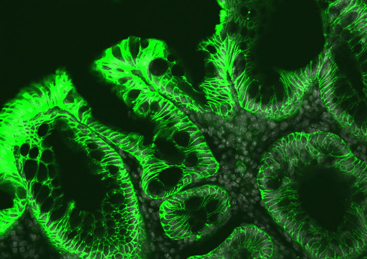 Broad Institute tweet media