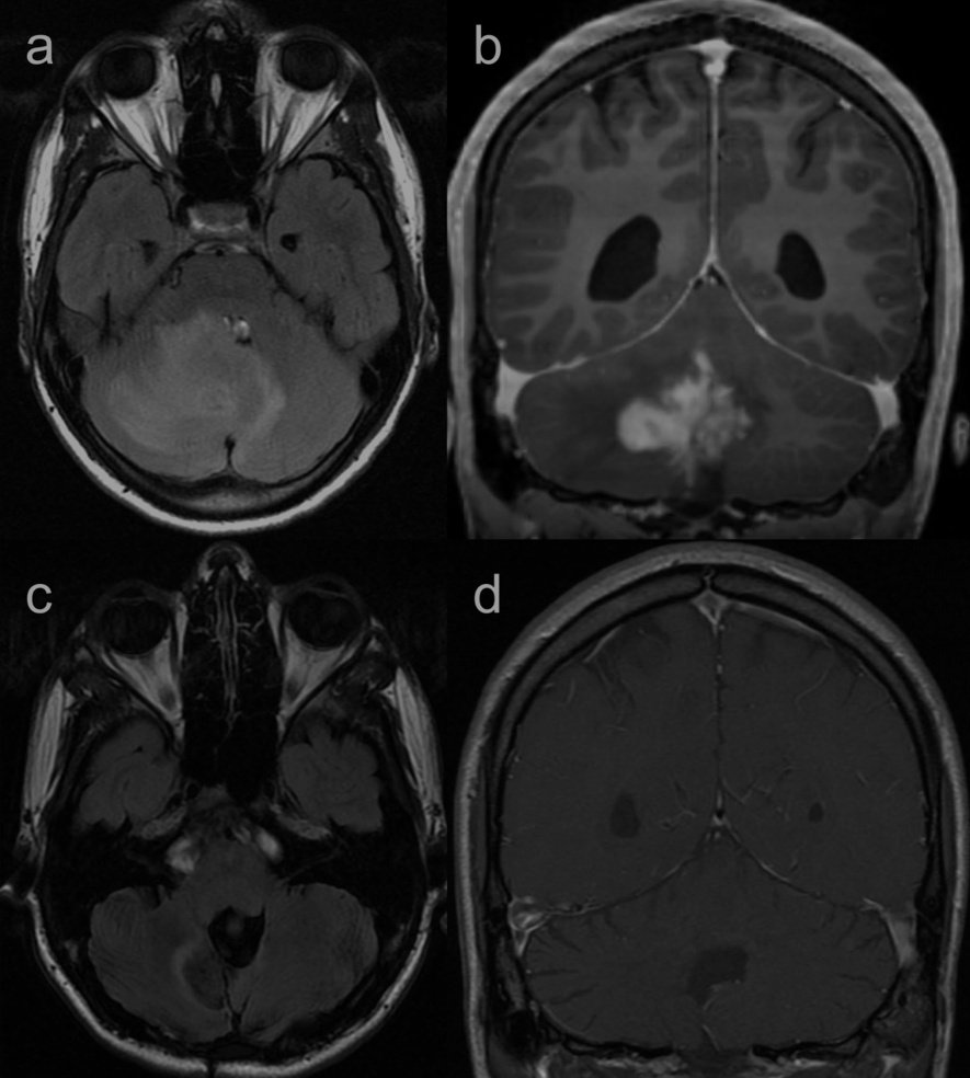 SPIN | Society of Pediatric Neuroimaging tweet media