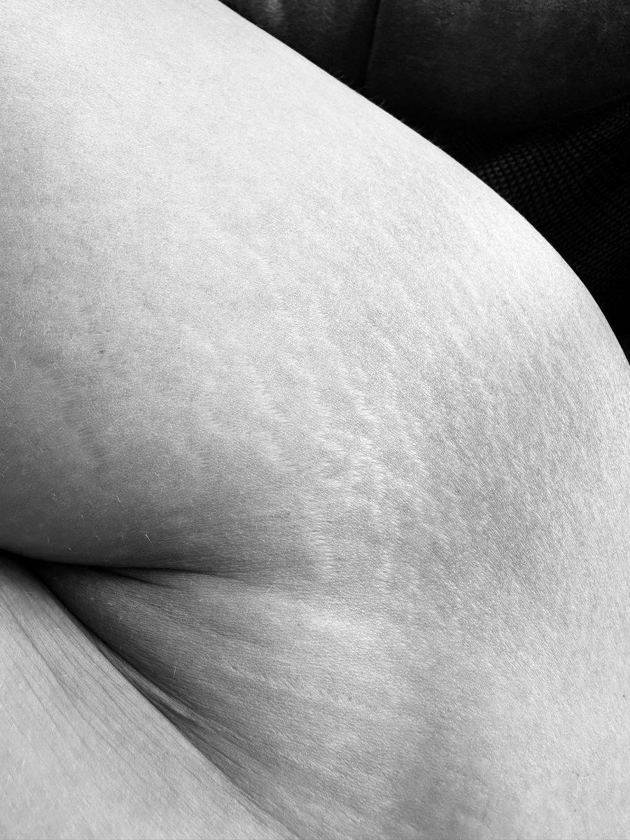 thenudistpaints's tweet photo. Proud of all of this.
The stretch marks
rolls
scars
Cellulite 
Jiggles

Perfectly imperfect and that’s just how I was meant to be ❤️. https://t.co/u4I71hZI1E