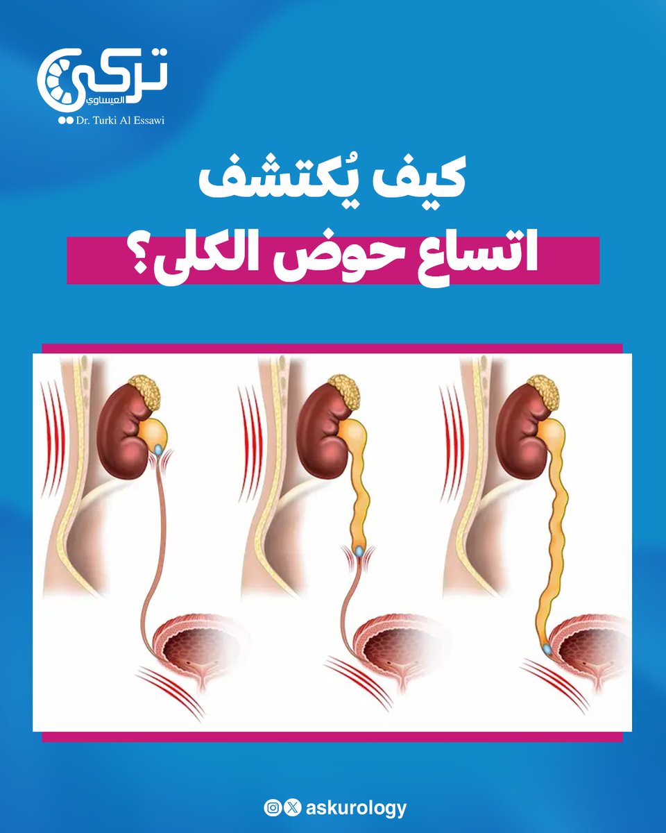 تركي العيساوي @ Turki Al Essawi tweet media