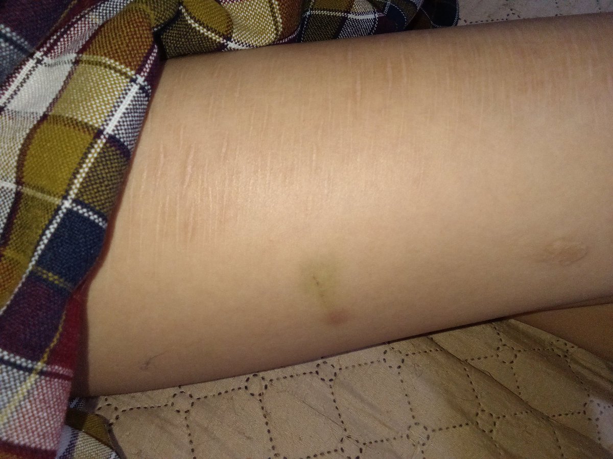 ⋆ conn. 🦇 tweet media