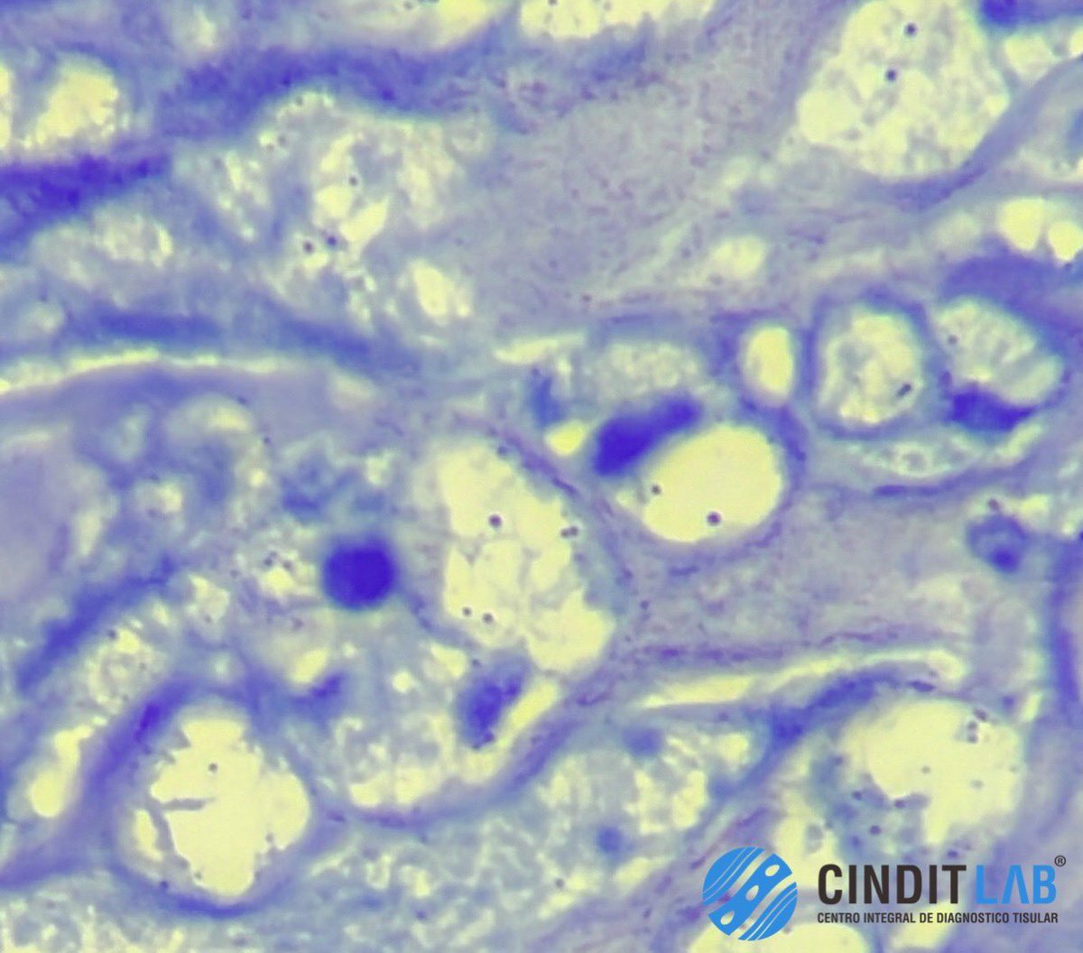 md_castaneda23's tweet image. Bacilos de Koch 
Mycobacterium Tuberculosis 

#pathologylab #cinditlab