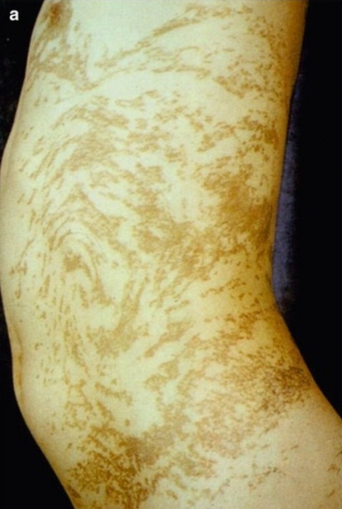 LILIES FREDERICK 4 ALU tweet media