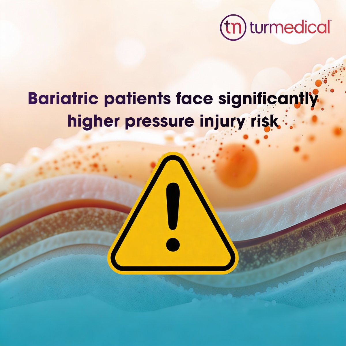TurnMedical's tweet photo. Bariatric ICU patients in prone face elevated pressure injury risk—especially on the face &amp; chest. 

InteliDerm® actively removes moisture, cools skin, and redistributes pressure to help protect high-risk areas.

#ICU #PressureInjuryPrevention #BariatricCare #PronePositioning https://t.co/3AsiPtV3Ux