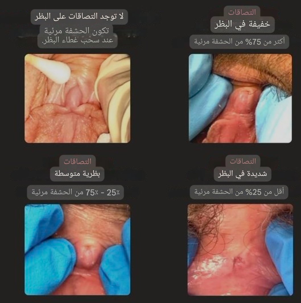 صحتي tweet media