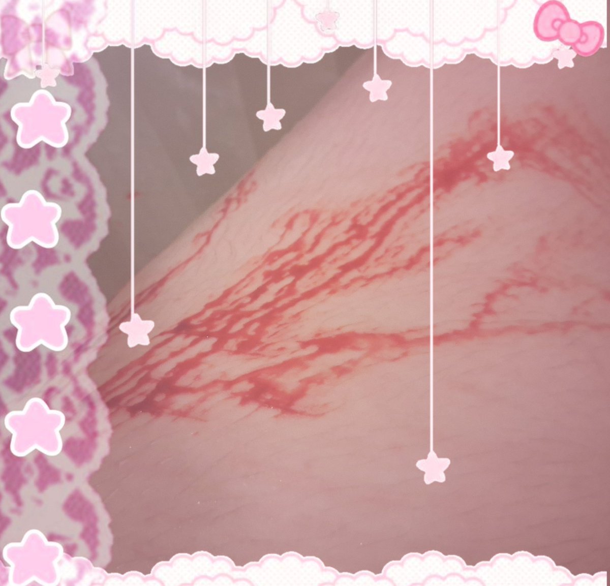 Hakuka_Flower's tweet image. Ignore  how  fat  my  thigh  is  &amp;lt;/3

#shedtwtᅠ #shtwt    #owchie