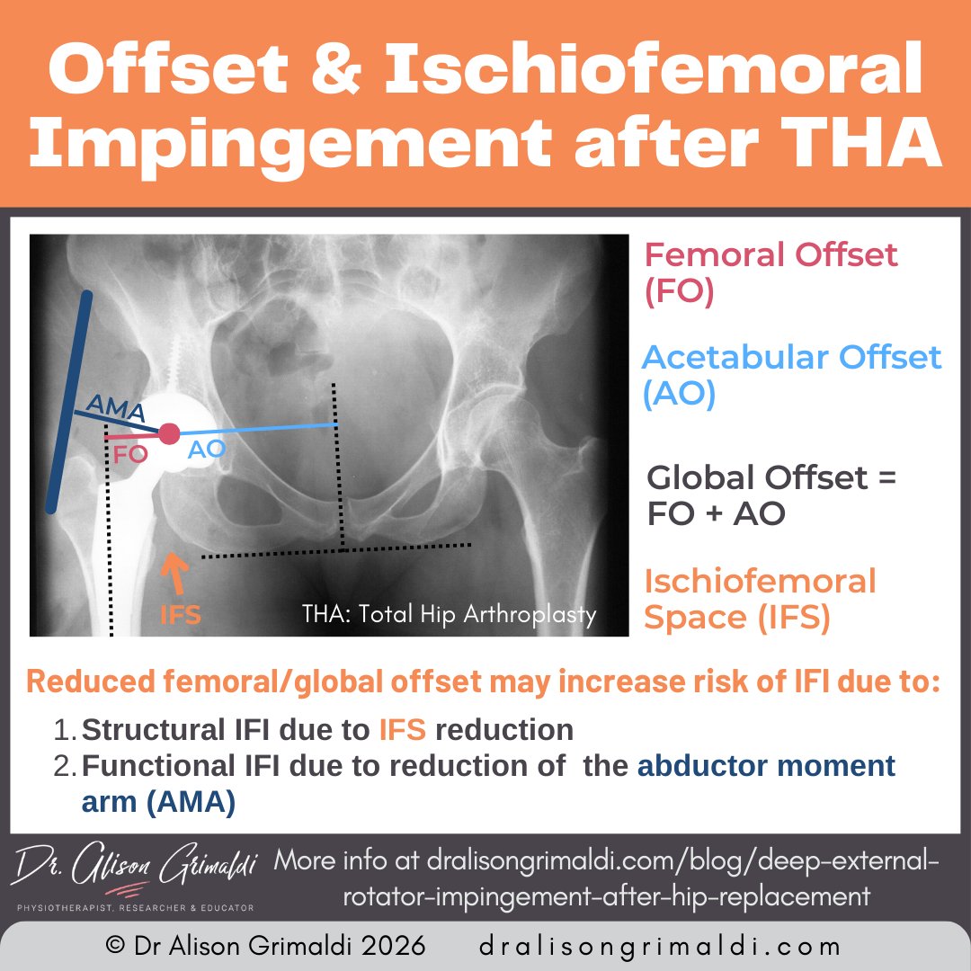 alisongrimaldi's tweet image. 🦴 Post-THA hip pain? Femoral &amp;amp; global offset affect the risk of Ischiofemoral Impingement (IFI):
✅ Reduced space → structural impingement
✅ Abductor leverage ↓ → functional impingement
Learn more 👉 dralisongrimaldi.com/blog/deep-exte…
#THA #HipPhysio #HipPain #PhysioTips