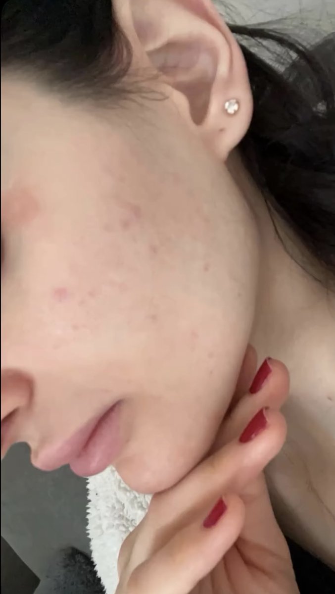 ديما tweet media