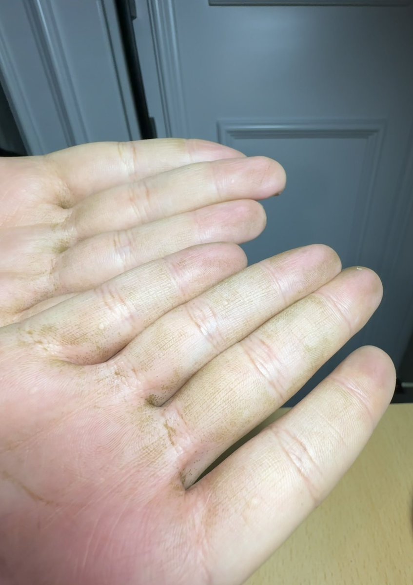 mercimek köftesi 🇹🇷 tweet media