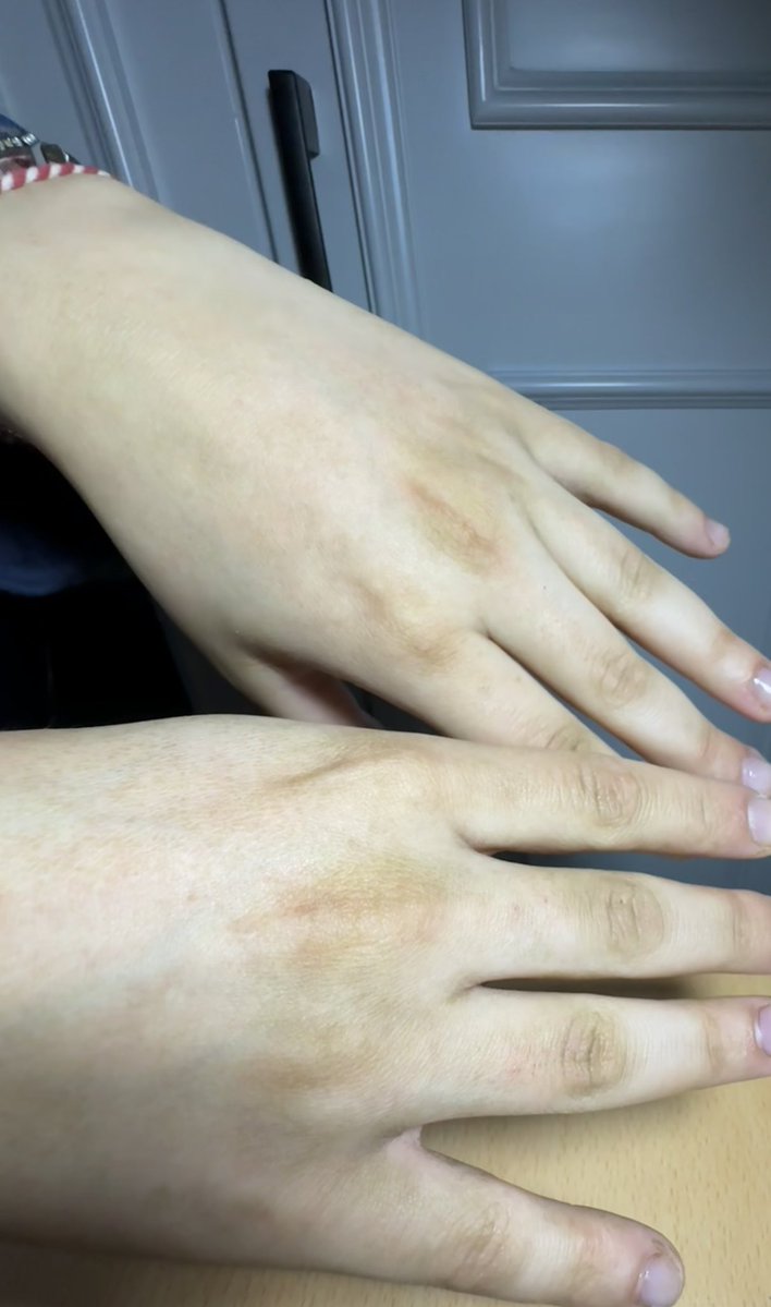 mercimek köftesi 🇹🇷 tweet media