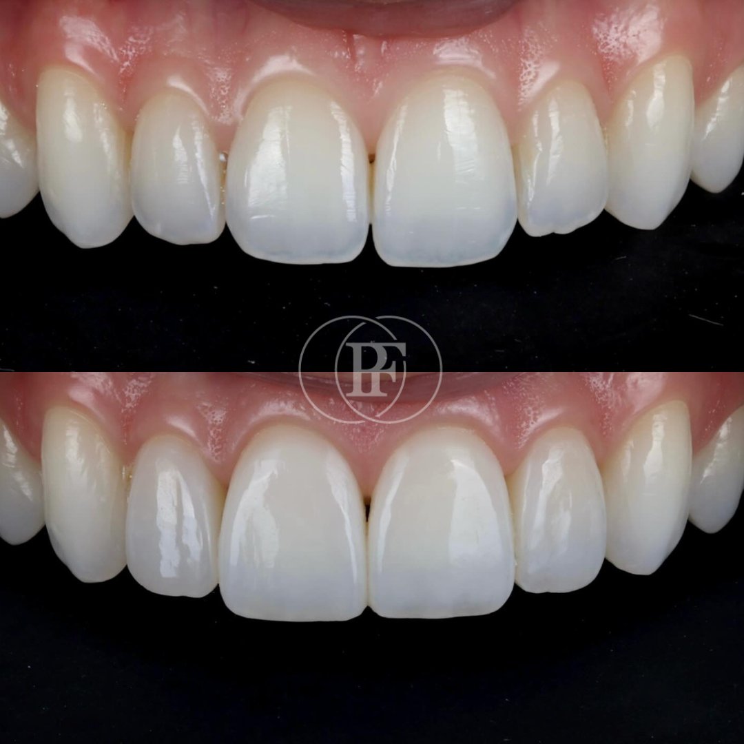 Pain Free Dentistry Group tweet media