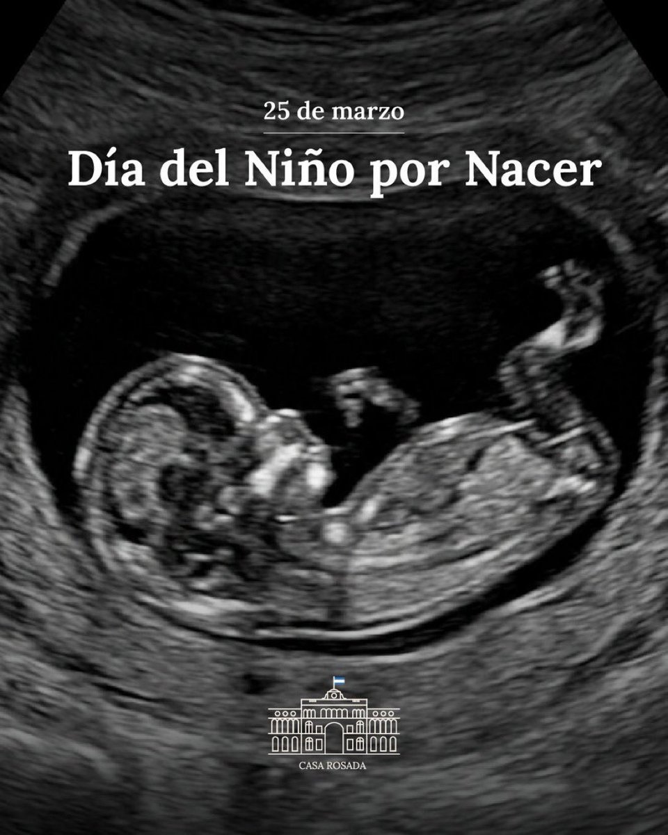 eve_barroso's tweet photo. Como mamá, no hay mayor alegría que saber que una nueva vida se está gestando en tu vientre. Tampoco hay responsabilidad más grande que cuidarla y protegerla.

En el Día del Niño por Nacer, reafirmamos nuestra postura frente a una realidad en la que se intenta deshumanizar a quienes están en gestación, vidas con identidad propia y un propósito.

Como sociedad, estamos llamados a tomar conciencia de su valor y a defender la vida desde la concepción.