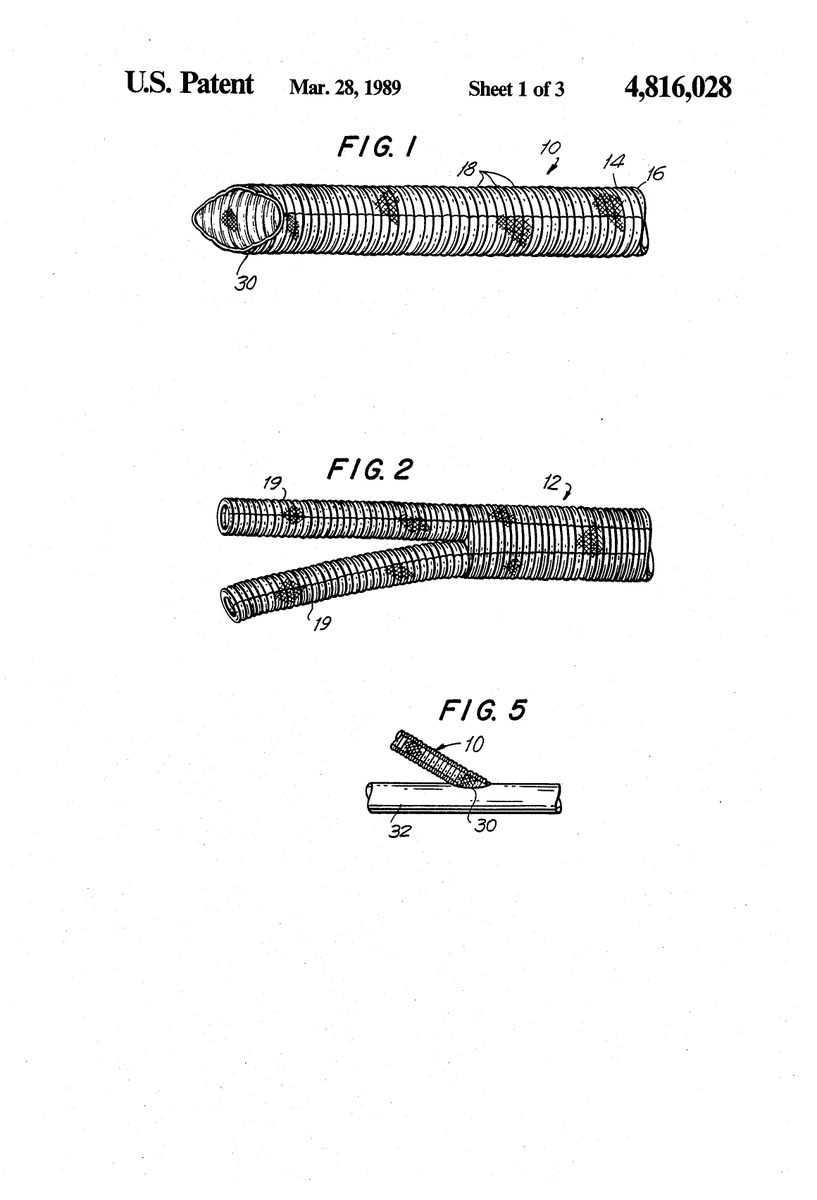 PatentArtBot's tweet photo. Woven vascular graft
Invented By: Indu Kapadia
Patent Number: US4816028A
https://t.co/MczpHBlGUs https://t.co/541UkzjMRc