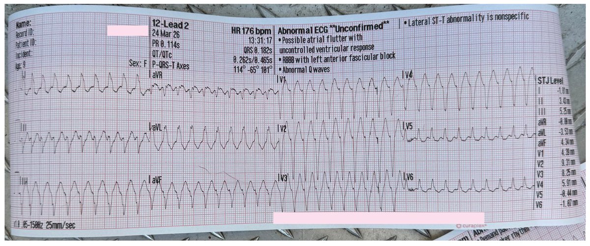 Peter Antevy tweet media