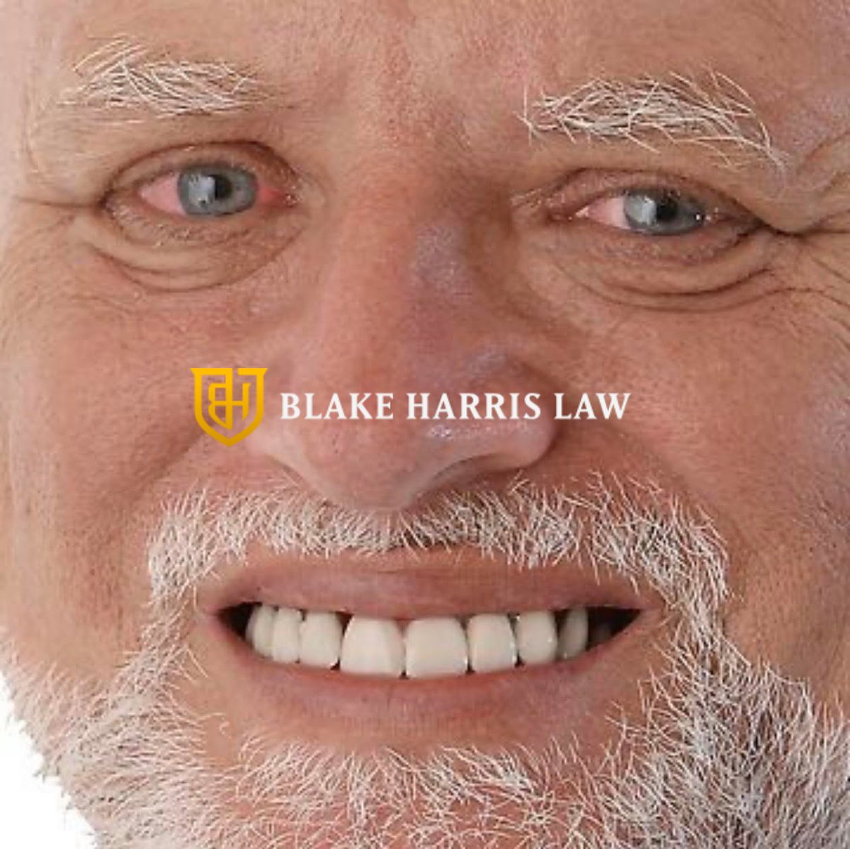 blakeharrislaw's tweet image. The look you get when you ask a Domestic Asset Protection Attorney whether their planning can be disregarded by a U.S. court

blakeharrislaw.com/blog/downsides… 

HybridDAPT.com

#AssetProtection #WealthProtection #OffshorePlanning #Trusts #LegalStrategy #EstatePlanning