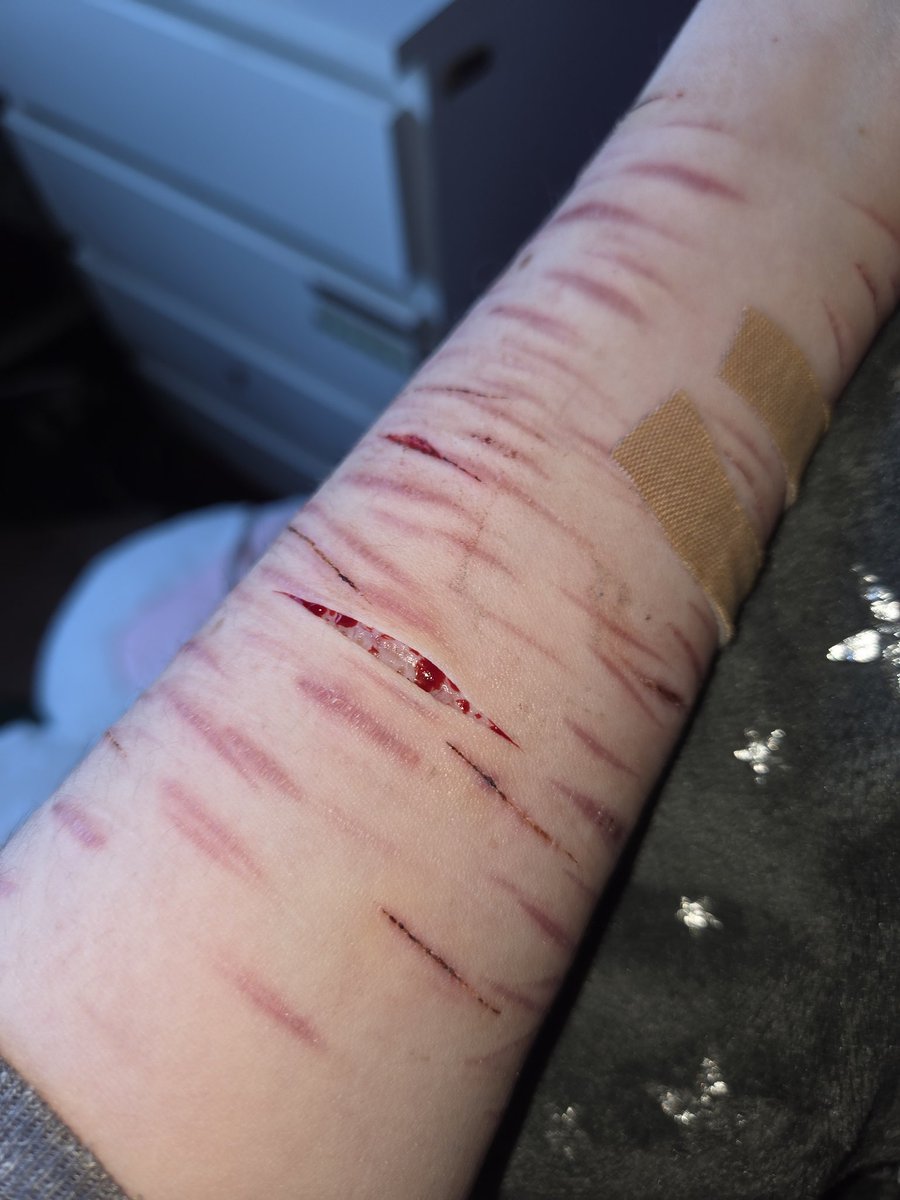 ℍ𝕒𝕔𝕙𝕚𝕨𝕒𝕣𝕖𝕤𝔹𝕚𝕘𝕋𝕠𝕖 (shtwt) tweet media