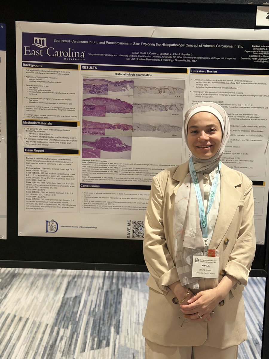 ZeinabKhalill's tweet photo. Honored to present our work at ISDP on sebaceous carcinoma in situ and porocarcinoma in situ. Grateful for the opportunity to share this work and looking forward to learning from the discussions and presentations at the meeting. #ISDPDenver2026 #Dermpath #ISDP https://t.co/HXQdTU7ARk