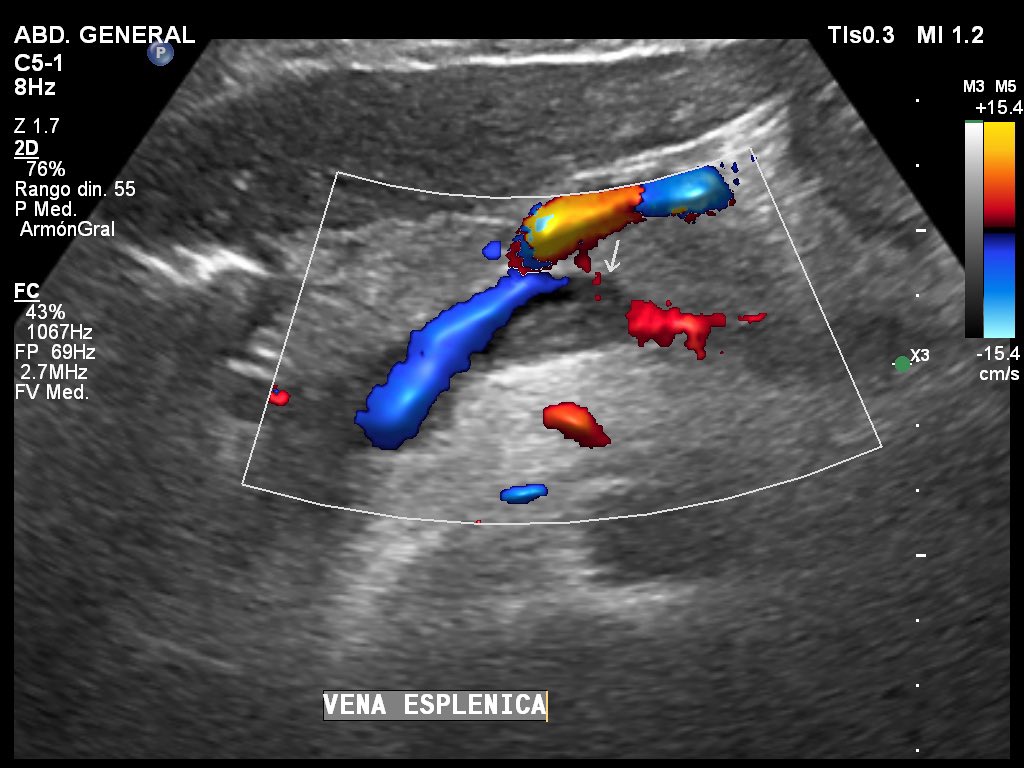 José S. Vaque Ramírez, MD tweet media