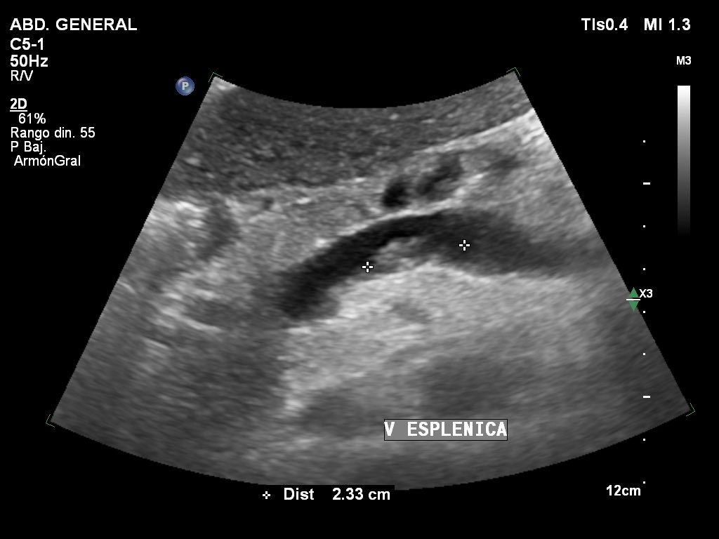 José S. Vaque Ramírez, MD tweet media